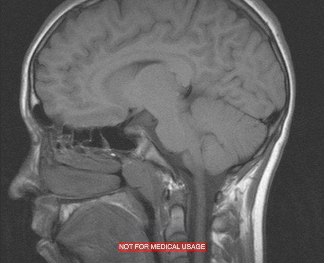 MRI_Jake_1