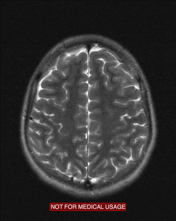 MRI_Jake_2